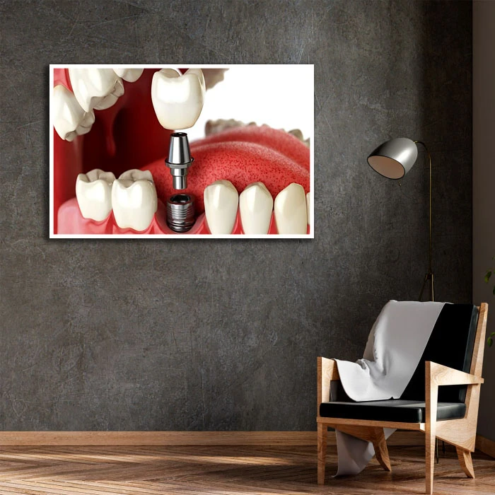 تابلو بکلیت طرح دندانپزشکی مدل W-D2182 فریم سفید