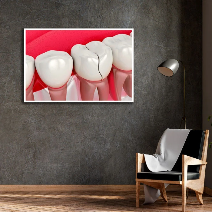 تابلو نوری بکلیت طرح دندانپزشکی مدل W-D2290 فریم سفید