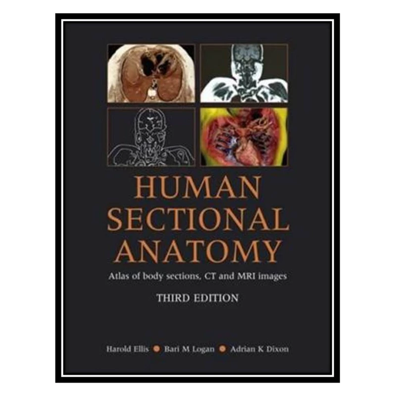 کتاب Human Sectional Anatomy: Atlas of Body Sections, CT and MRI Images, 3rd Edition اثر جمعی از نویسندگان انتشارات مؤلفین طلایی