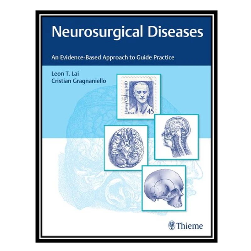 کتاب Neurosurgical Diseases: An Evidence-Based Approach to Guide Practice اثر  Leon Lai and Cristian Gragnaniello انتشارات مؤلفین طلایی