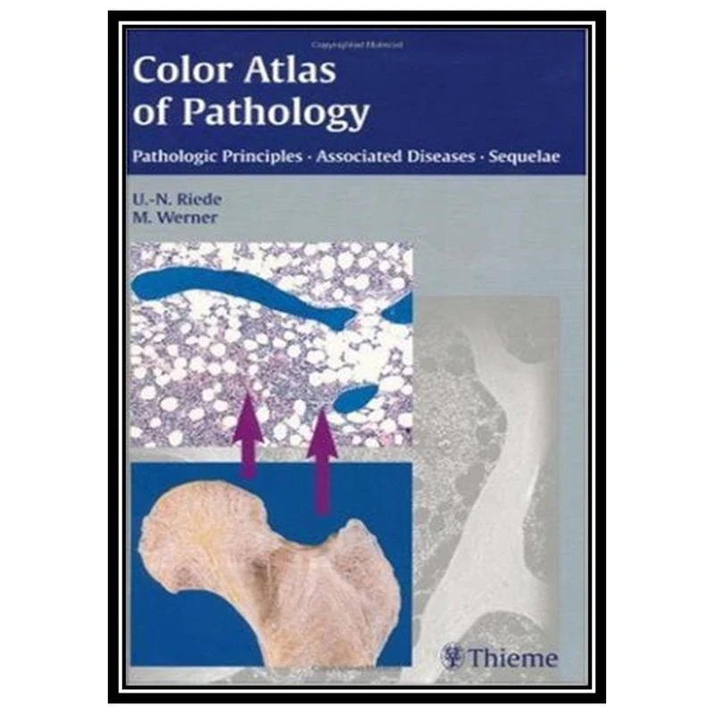 کتاب Color Atlas of Pathology: Pathologic Principles, Associated Diseases, Sequelae اثر Ursus-Nikolaus Riede and Martin Werner انتشارات مؤلفین طلایی
