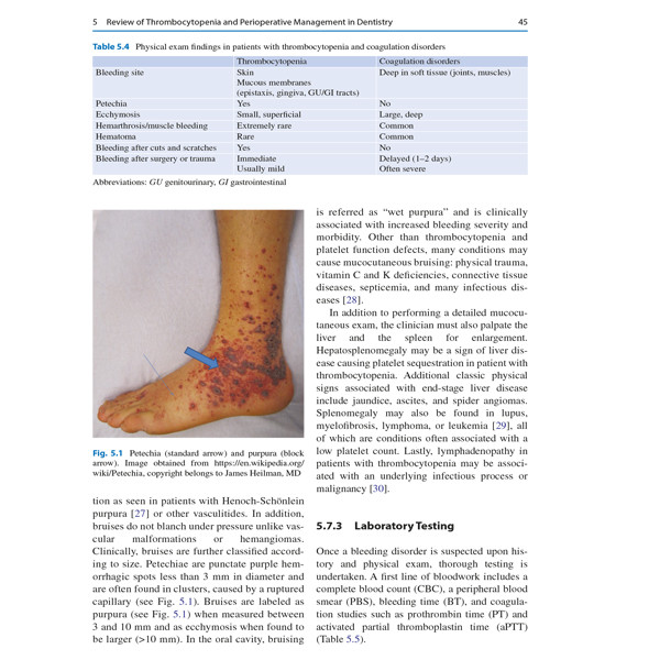 قیمت و خرید کتاب Hemostasis in Dentistry اثر Richard Szumita انتشارات