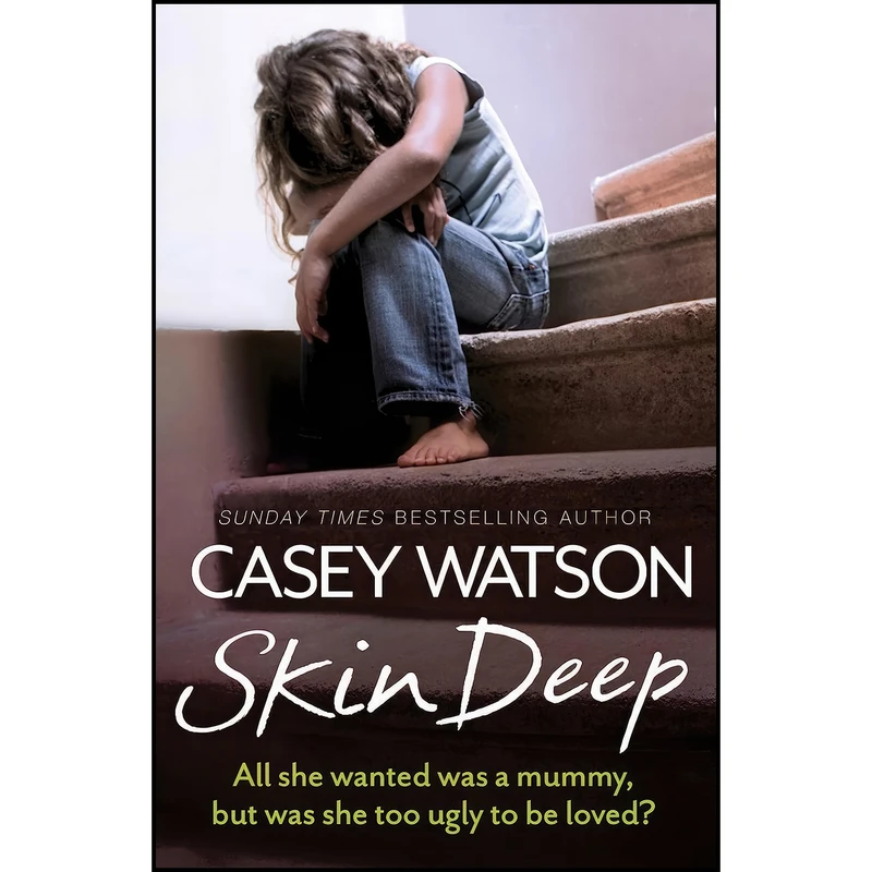 کتاب Skin Deep اثر Casey Watson انتشارات HarperElement