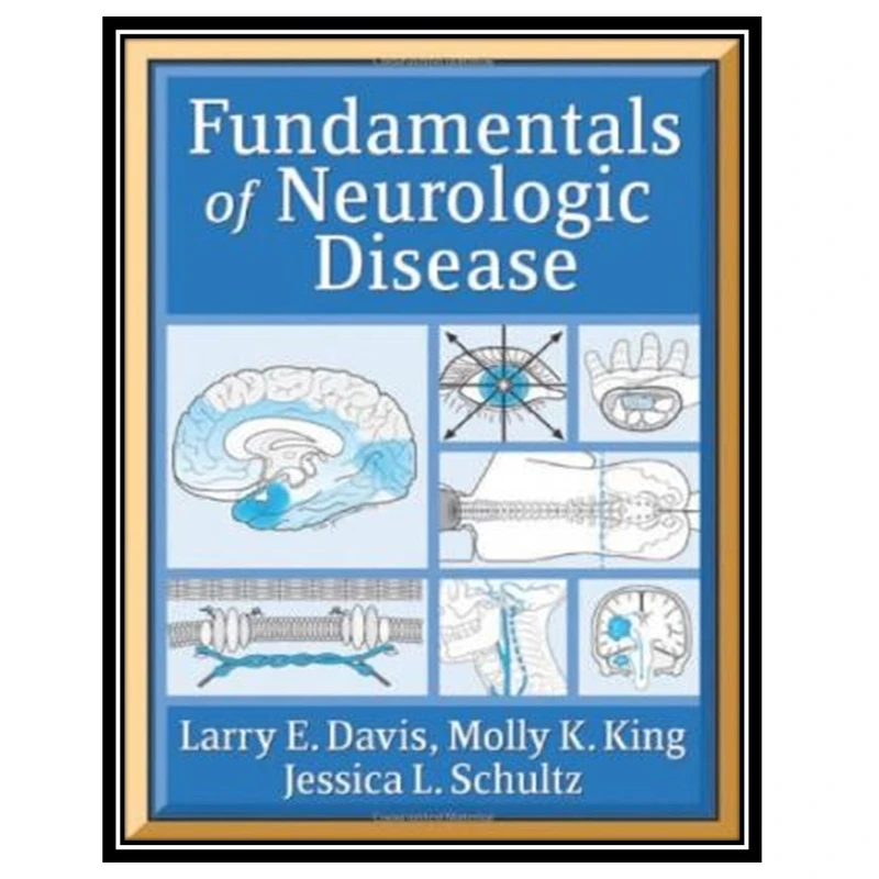 کتاب Fundamentals of Neurologic Disease اثر جمعی از نویسندگان انتشارات مؤلفین طلایی