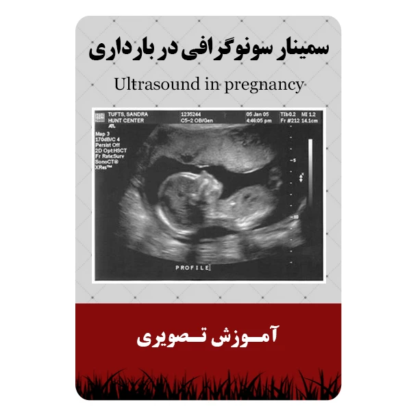 ویدئو آموزش سمینار سونوگرافی در بارداری نشر برج