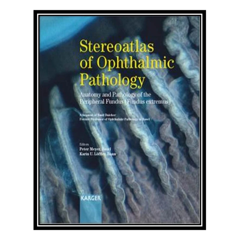 کتاب Stereoatlas of Ophthalmic Pathology اثر جمعی از نویسندگان انتشارات مؤلفین طلایی