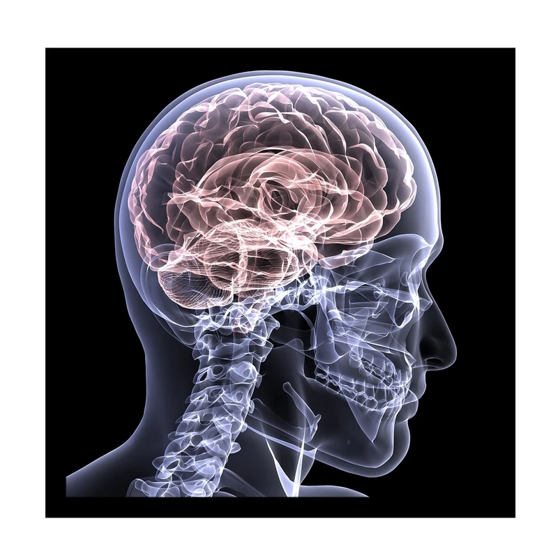 تابلو بکلیت طرح عکس رادیوگرافی نخاع و جمجمه مدل B-10610