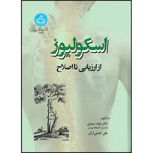 کتاب اسکولیوز؛ از ارزیابی تا اصلاح اثر دکتر فؤاد صیدی و علی کشتی آرای انتشارات دانشگاه تهران