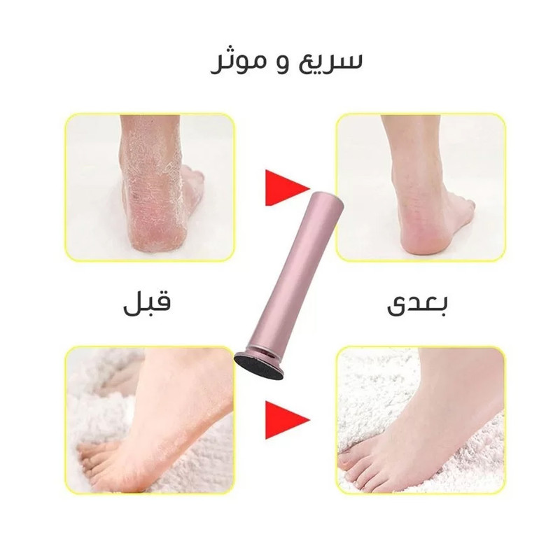 سنگ پا برقی دکتر اسکین مدل TL-DS02