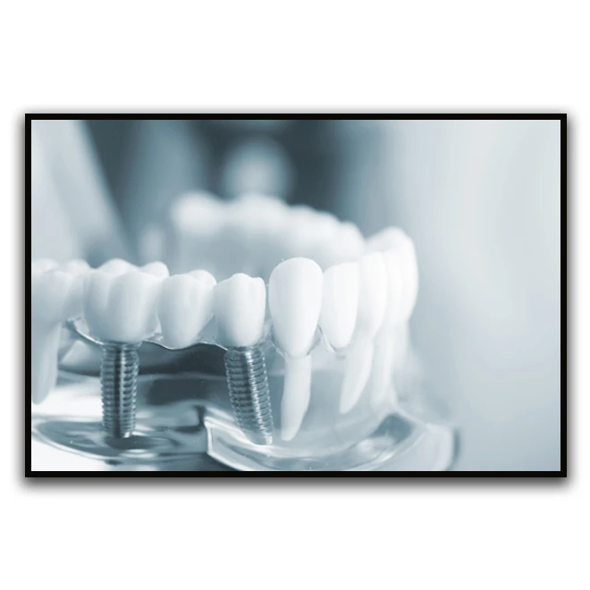 تابلو بکلیت طرح دندانپزشکی مدل B-D1171