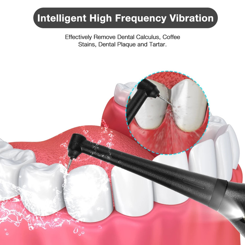 جرم گیر دندان برقی مدل DR-2550