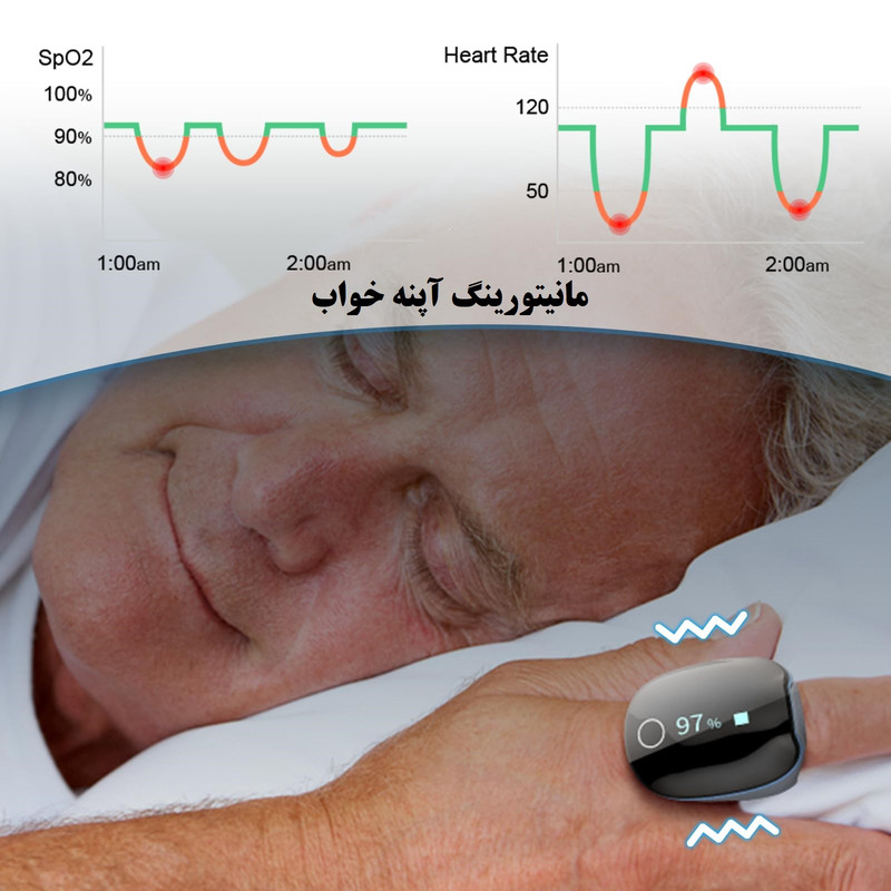 پالس اکسیمتر ولو مدل O2ring