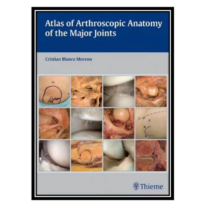 کتاب Atlas of Arthroscopic Anatomy of the Major Joints اثر Cristian Blanco Moreno انتشارات مؤلفین طلایی