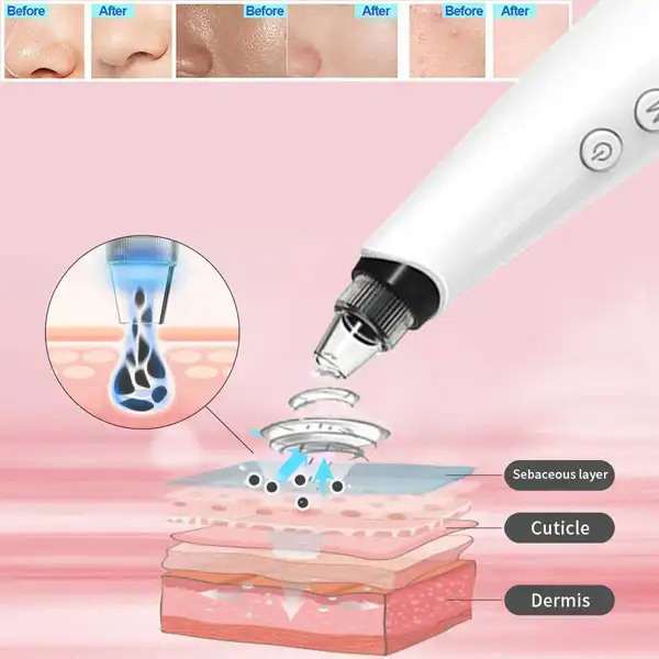 میکرودرم مدل JZC-Y03