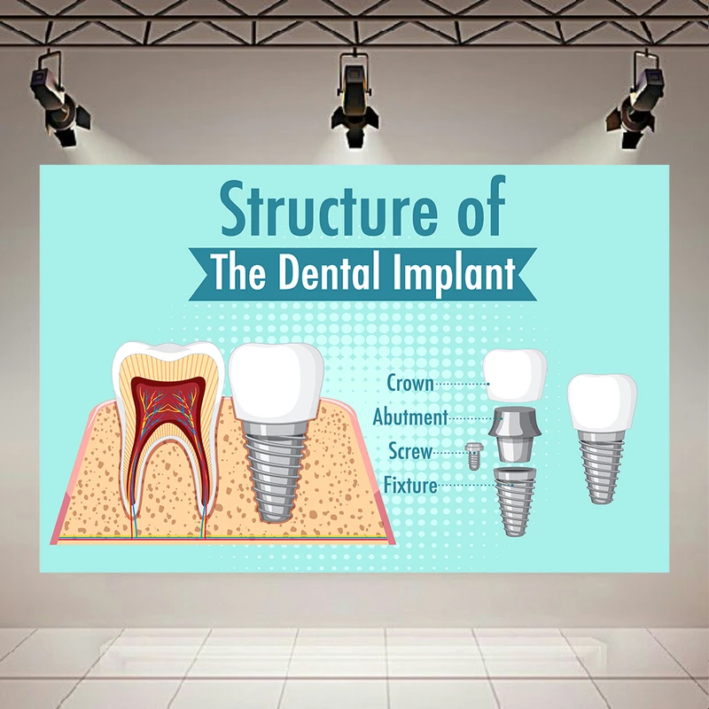 تابلو بوم طرح مخمل ایمپلنت دندان مدل دندانپزشکی کد AR305514