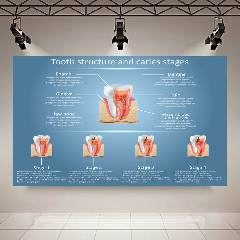 پوستر دیواری طرح دندانپزشکی مدل مراقبت از دندان کد AR305788