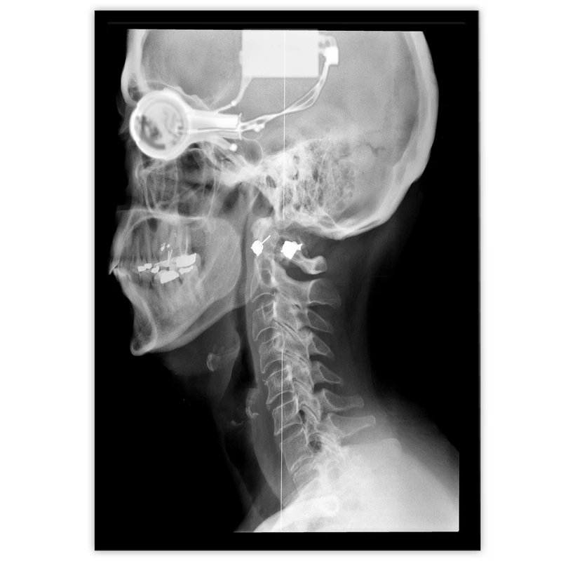 تابلو بکلیت طرح رادیوگرافی جمجمه و نخاع مدل B-10648