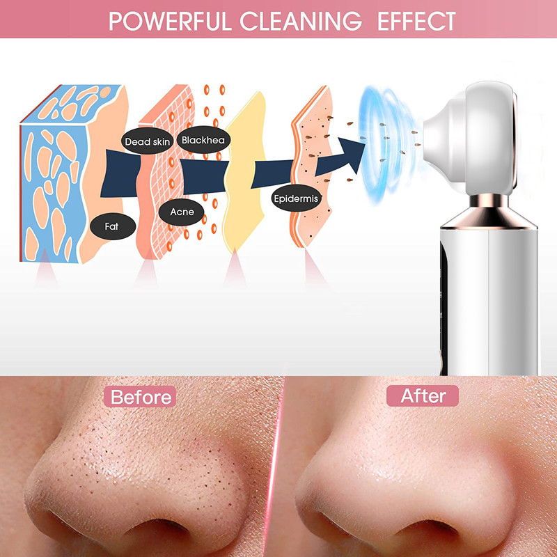 میکرودرم گلویش استایل مدل Magnifier