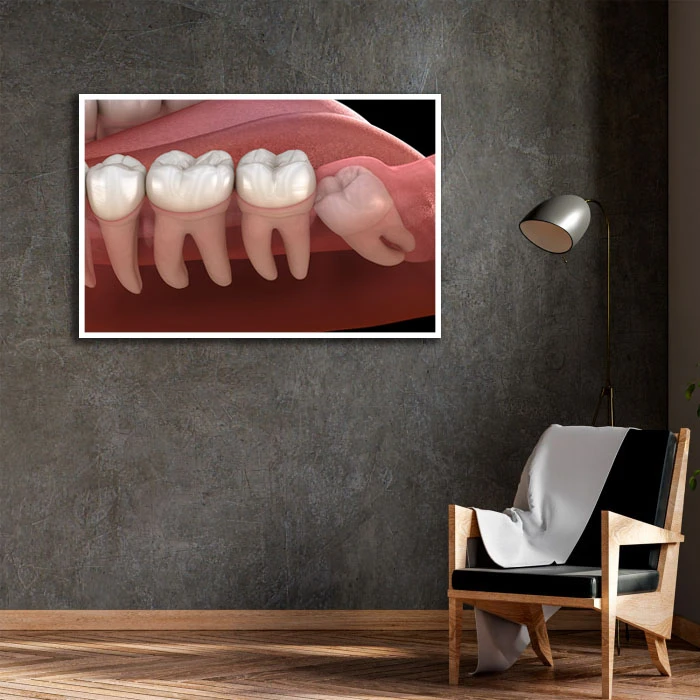 تابلو بکلیت طرح دندانپزشکی مدل W-D2195 فریم سفید