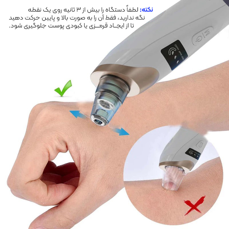 میکرودرم خانگی مدل 8826-3w