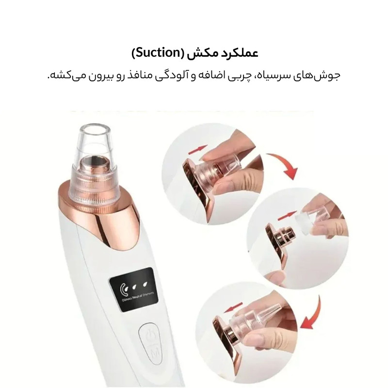 میکرودرم وینچر مدل Win