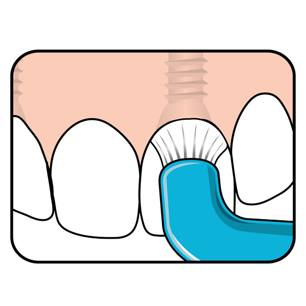 مسواک تهپه مدل Compact Tuft با برس نرم مسواک تهپه مدل Compact Tuft با برس نرم