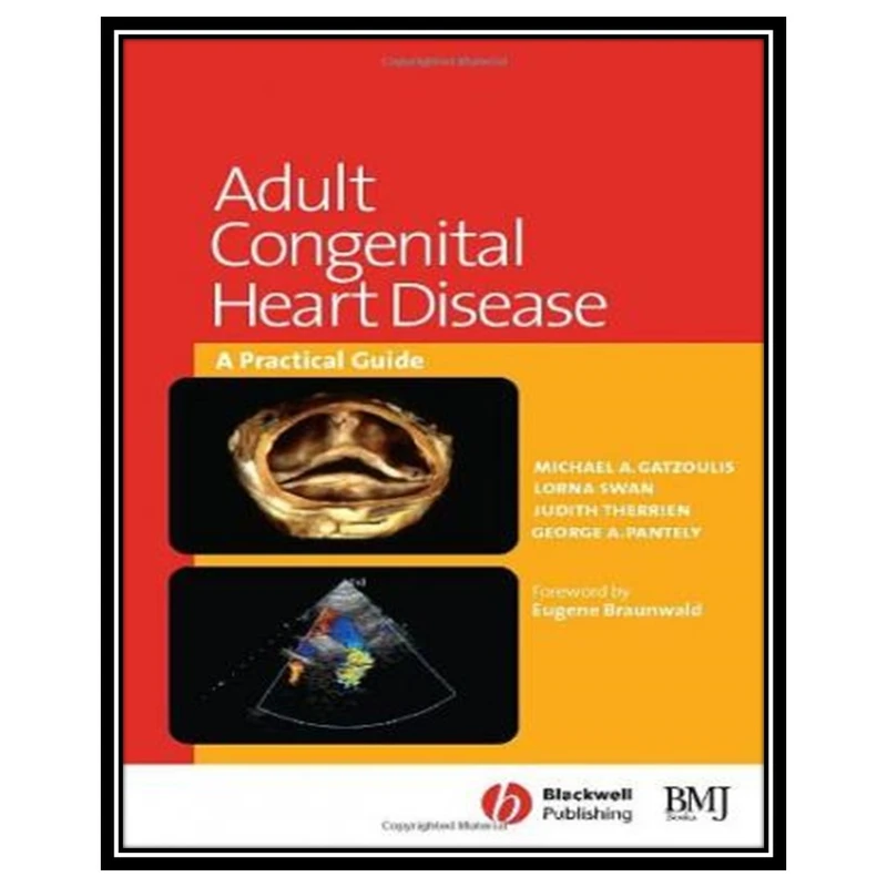 کتاب Adult Congenital Heart Disease: A Practical Guide اثر جمعی از نویسندگان انتشارات مؤلفین طلایی