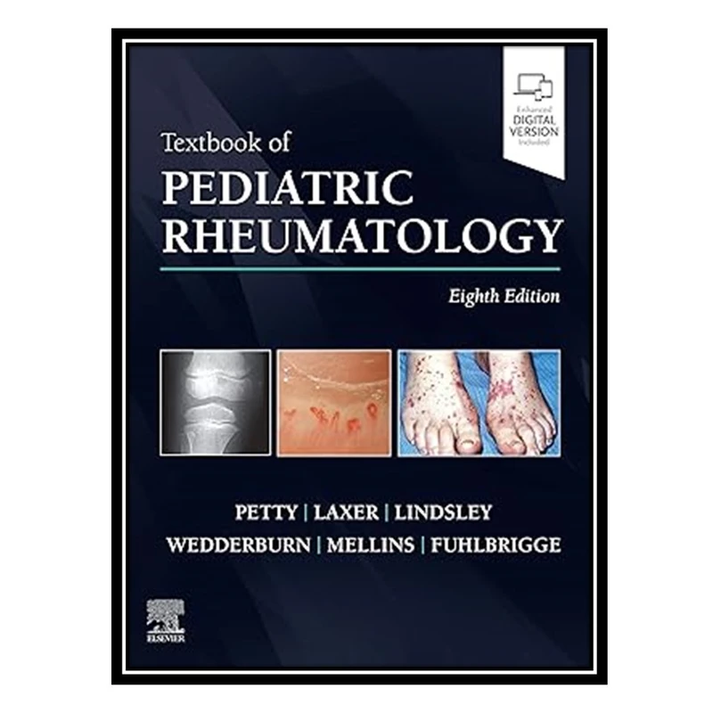 کتاب Textbook of Pediatric Rheumatology اثر جمعی از نویسندگان انتشارات مؤلفین طلایی