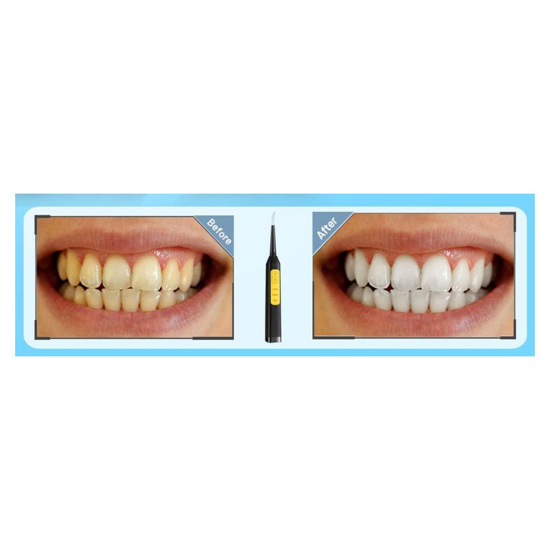دستگاه جرم گیر خانگی مدل X0019WF1M3 دستگاه جرم گیر خانگی مدل X0019WF1M3