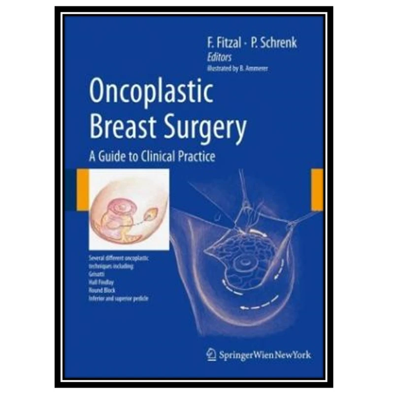 کتاب Oncoplastic Breast Surgery: A Guide to Clinical Practice اثر جمعی از نویسندگان انتشارات مؤلفین طلایی