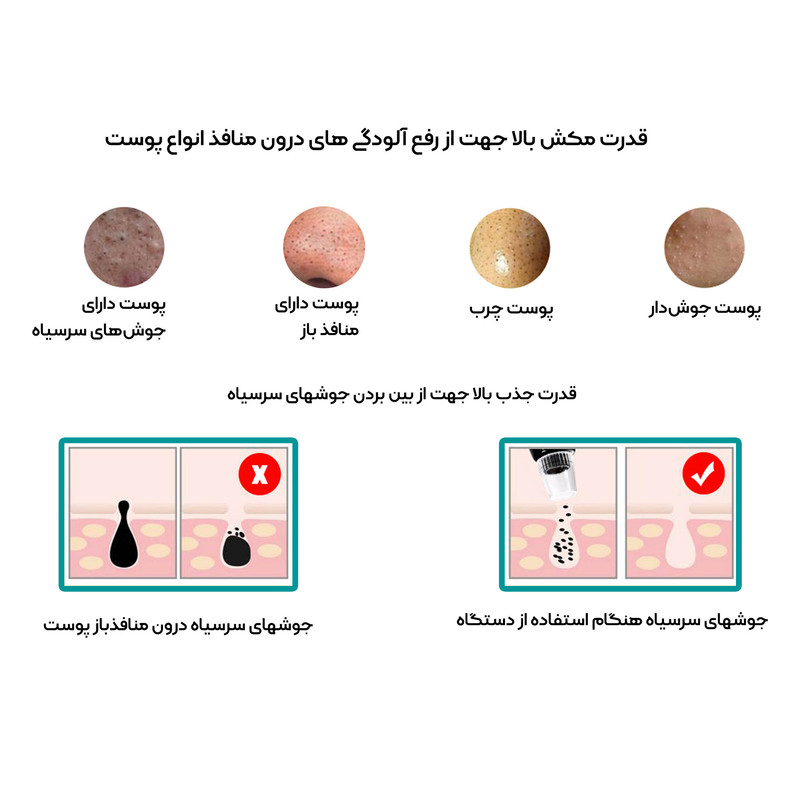 میکرودرم خانگی مدل JHF15 میکرودرم خانگی مدل JHF15
