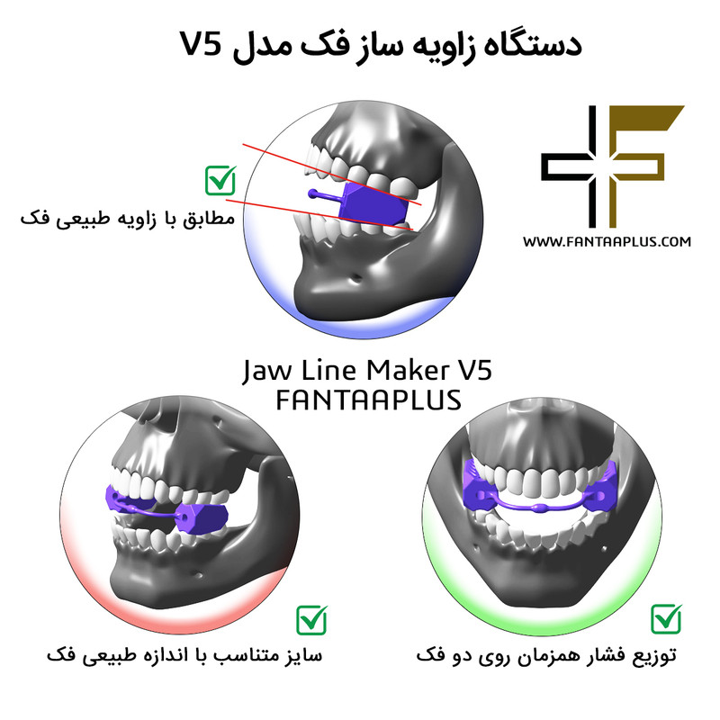 دستگاه زاویه ساز فک و فرم دهی صورت مدل V6 بسته 3 عددی