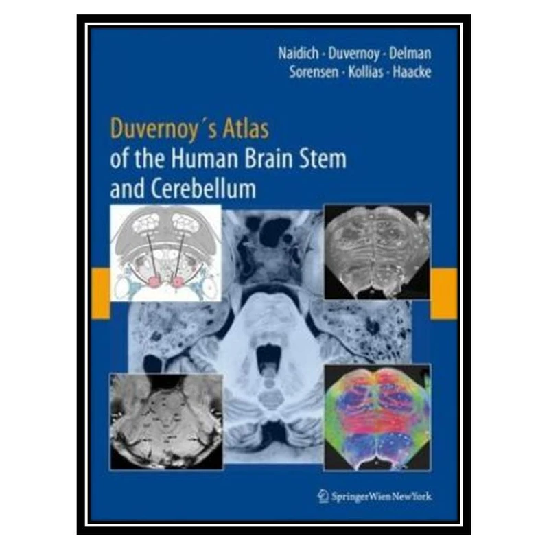 کتاب Duvernoys Atlas of the Human Brain Stem and Cerebellum اثر جمعی از نویسندگان انتشارات مؤلفین طلایی