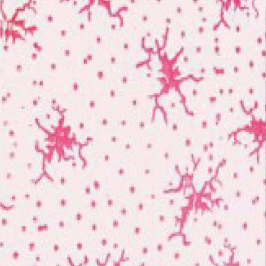 غلتک نقاشی مدل Y009 سایز 6 اینچ غلتک نقاشی مدل Y009 سایز 6 اینچ