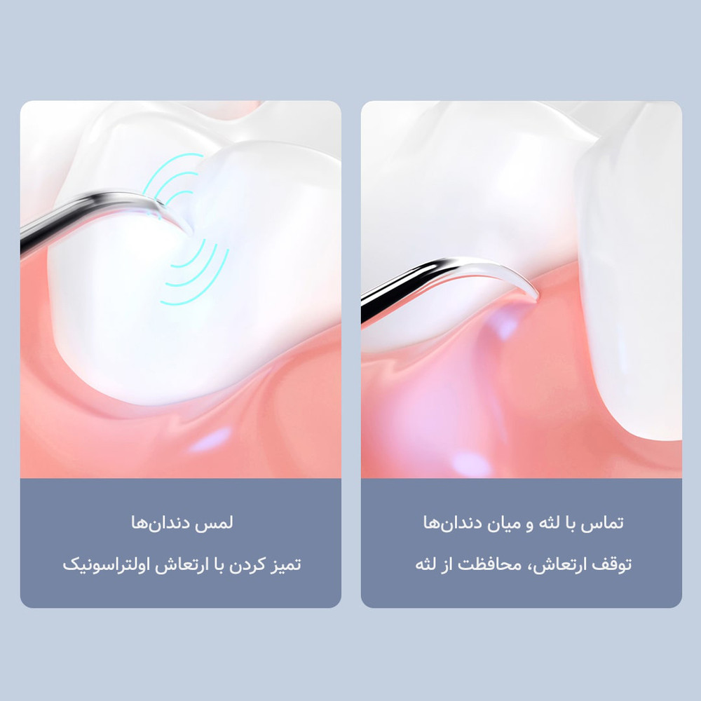 دستگاه جرم گیر دندان سانائو مدل T11Pro