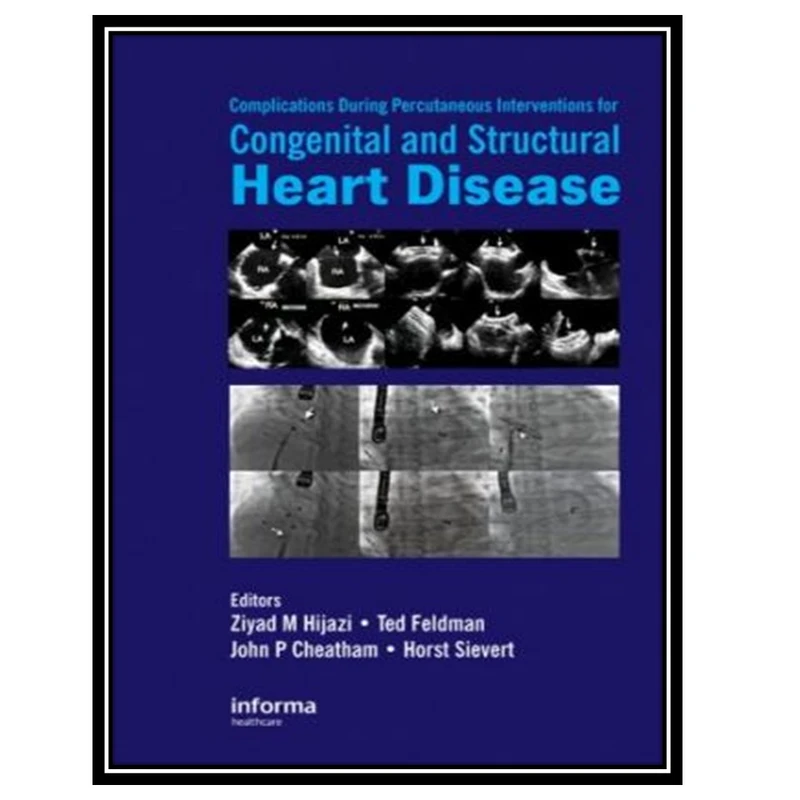 کتاب Complications During Percutaneous Interventions for Congenital and Structural Heart Disease اثر جمعی از نویسندگان انتشارات مؤلفین طلایی