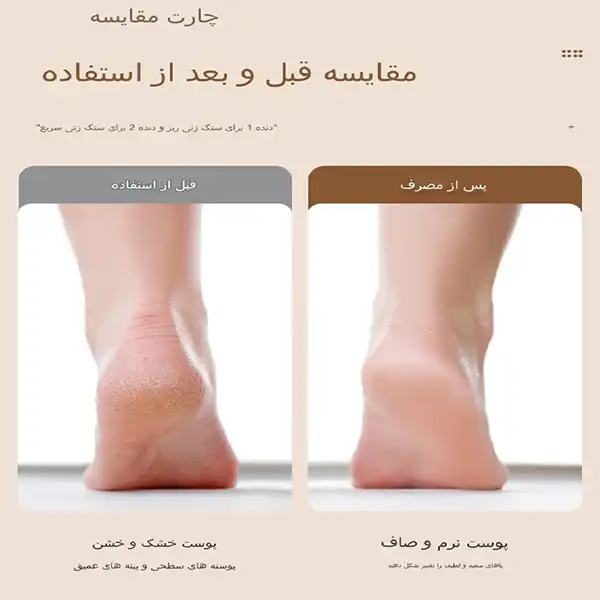 سنگ پا برقی مدل 1ZS