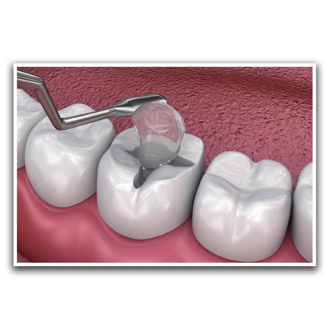 تابلو بکلیت طرح دندانپزشکی مدل W-D1176