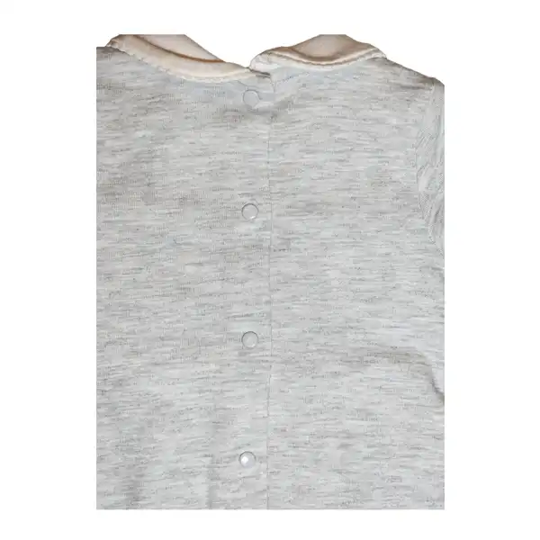 سرهمی نوزادی او وی اس کد 5499