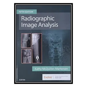 کتاب Radiographic Image Analysis اثر Kathy Mcquillen Martensen انتشارات مؤلفین طلایی